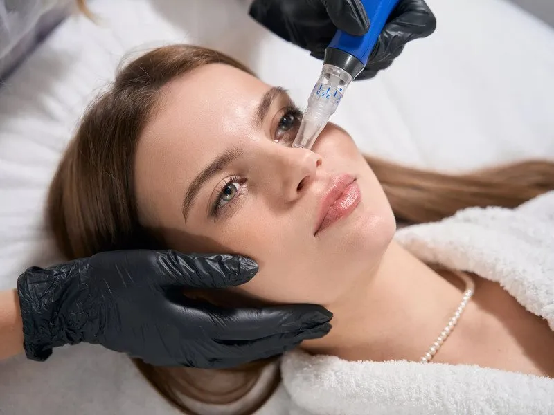 Mikrojehličková radiofrekvence: Omlazující procedura obličeje