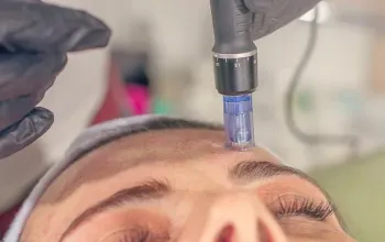 Mikrojehličková radiofrekvence: Omlazující procedura obličeje