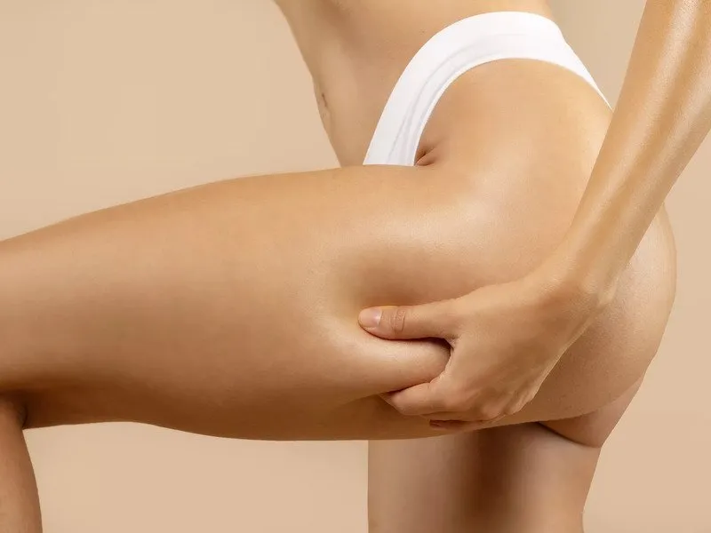 Neinvazivní liposukce: Ultrazvuková kavitace